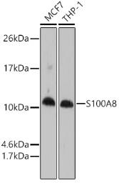 Anti-S100A8 antibody used in Western Blot (WB). GTX54721