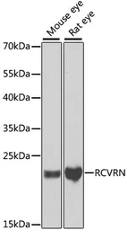 Anti-Recoverin antibody used in Western Blot (WB). GTX54724
