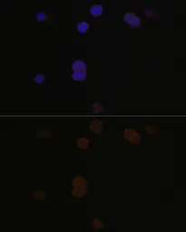 Anti-Recoverin antibody used in Immunocytochemistry/ Immunofluorescence (ICC/IF). GTX54724