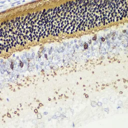 Anti-Recoverin antibody used in IHC (Paraffin sections) (IHC-P). GTX54724