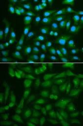 Anti-Sorbitol Dehydrogenase antibody used in Immunocytochemistry/ Immunofluorescence (ICC/IF). GTX54728