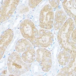 Anti-Sorbitol Dehydrogenase antibody used in IHC (Paraffin sections) (IHC-P). GTX54728