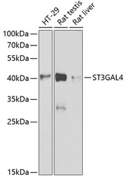 Anti-ST3GAL4 antibody used in Western Blot (WB). GTX54730