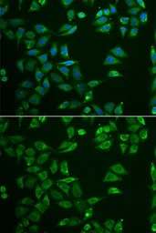 Anti-ST3GAL4 antibody used in Immunocytochemistry/ Immunofluorescence (ICC/IF). GTX54730