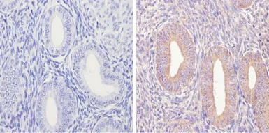Anti-eIF2B3 antibody [1H3] used in IHC (Paraffin sections) (IHC-P). GTX54741