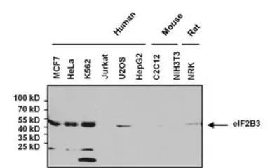 Anti-eIF2B3 antibody [1H3] used in Western Blot (WB). GTX54741