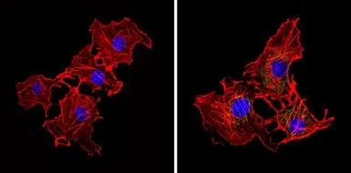 Anti-eIF2B3 antibody [1H3] used in Immunocytochemistry/ Immunofluorescence (ICC/IF). GTX54741