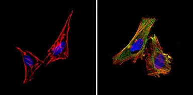 Anti-eIF2B3 antibody [1H3] used in Immunocytochemistry/ Immunofluorescence (ICC/IF). GTX54741