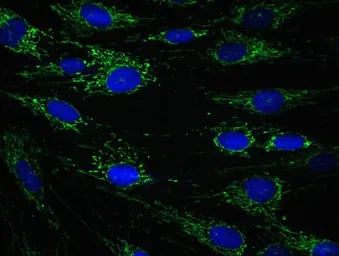 Anti-ECH1 antibody [9D11AF3] used in Immunocytochemistry/ Immunofluorescence (ICC/IF). GTX54746