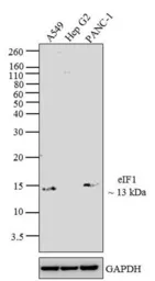 Anti-eIF1 antibody [2B9] used in Western Blot (WB). GTX54748