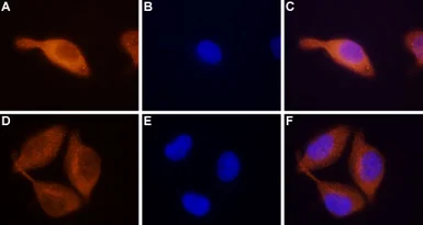 Anti-STIM2 antibody used in Immunocytochemistry/ Immunofluorescence (ICC/IF). GTX54768