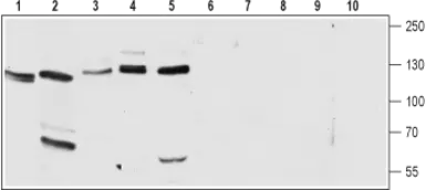 Anti-Cav alpha 2/delta 2 antibody used in Western Blot (WB). GTX54770