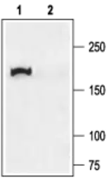 Anti-CFTR antibody used in Western Blot (WB). GTX54774