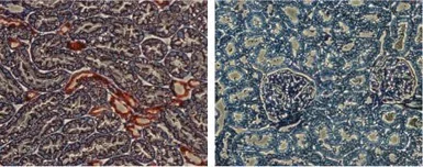 Anti-KCNJ1 / ROMK antibody used in IHC (Frozen sections) (IHC-Fr). GTX54775