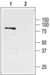 Anti-KCNJ1 / ROMK antibody used in Western Blot (WB). GTX54775