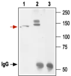 Anti-Kv11.1 antibody used in Immunoprecipitation (IP). GTX54776
