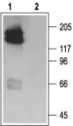Anti-Kv11.1 antibody used in Western Blot (WB). GTX54776
