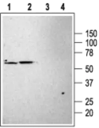 Anti-KCNK3 antibody used in Western Blot (WB). GTX54778