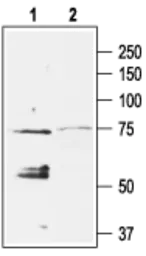 Anti-KIR3.4 antibody used in Western Blot (WB). GTX54780