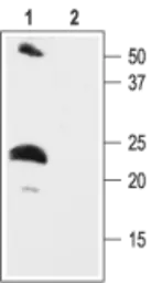 Anti-KCNE2 antibody used in Western Blot (WB). GTX54783