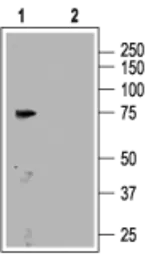 Anti-CNGA3 antibody used in Western Blot (WB). GTX54784
