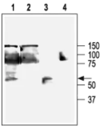 Anti-KCNN4 antibody used in Western Blot (WB). GTX54786