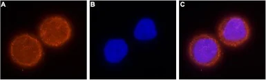 Anti-KCNH1 antibody used in Immunocytochemistry/ Immunofluorescence (ICC/IF). GTX54788