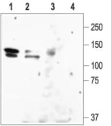 Anti-KCNH1 antibody used in Western Blot (WB). GTX54788