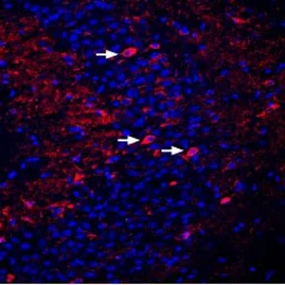 Anti-DPP6 antibody used in IHC (Free Floating) (IHC (Free Floating)). GTX54792
