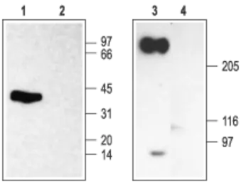Anti-Nav beta 2 antibody used in Western Blot (WB). GTX54799