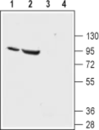 Anti-ENaC Alpha antibody used in Western Blot (WB). GTX54809