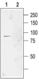 Anti-CLCN2 antibody used in Western Blot (WB). GTX54814