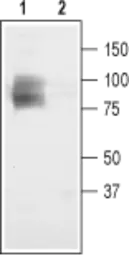 Anti-CLCN3 antibody used in Western Blot (WB). GTX54815