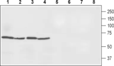 Anti-Ferroportin 1 antibody used in Western Blot (WB). GTX54821