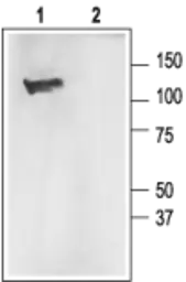 Anti-Maxi Potassium channel alpha antibody used in Western Blot (WB). GTX54828