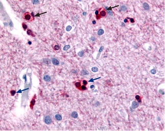 Anti-KCNN2 antibody used in IHC (Paraffin sections) (IHC-P). GTX54829