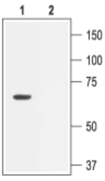Anti-KCNN2 antibody used in Western Blot (WB). GTX54829