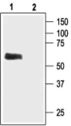 Anti-GIRK1 antibody used in Western Blot (WB). GTX54831
