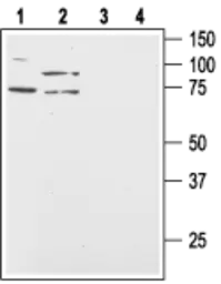 Anti-Orexin Receptor 2 antibody used in Western Blot (WB). GTX54848