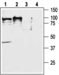 Anti-Orexin Receptor 2 antibody used in Western Blot (WB). GTX54848