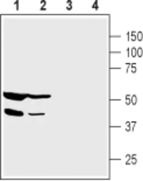 Anti-PICK1 antibody used in Western Blot (WB). GTX54853