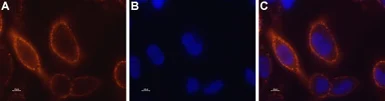 Anti-STIM1 antibody used in Live cell imaging (LCI). GTX54855