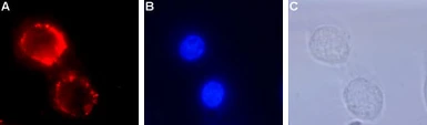 Anti-TrkA antibody used in Live cell imaging (LCI). GTX54856