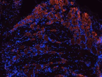 Anti-TrkB antibody used in IHC (Frozen sections) (IHC-Fr). GTX54857