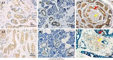 Anti-TrkC antibody used in IHC (Paraffin sections) (IHC-P). GTX54858