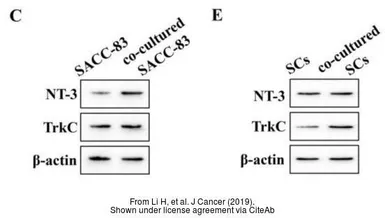 Anti-TrkC antibody used in Western Blot (WB). GTX54858