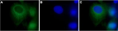 Anti-TRPC3 antibody used in Immunocytochemistry/ Immunofluorescence (ICC/IF). GTX54860