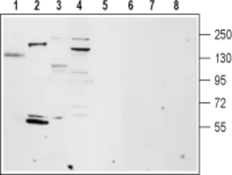 Anti-TRPM4 antibody used in Western Blot (WB). GTX54863
