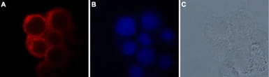 Anti-TRPM7 antibody used in Immunocytochemistry/ Immunofluorescence (ICC/IF). GTX54865