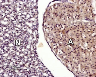 Anti-TRPM7 antibody used in IHC (Paraffin sections) (IHC-P). GTX54865